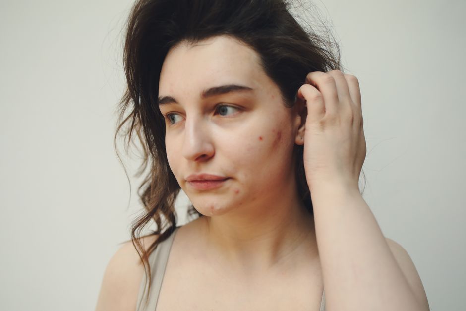 acne skincare treatment dermatology telehealth care