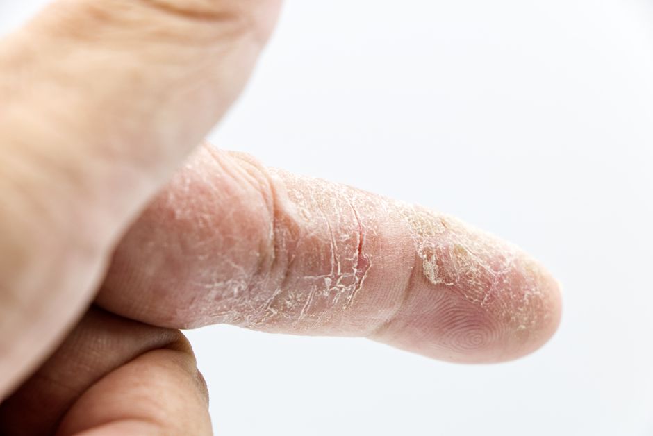 skin condition dermatology treatment telehealth care